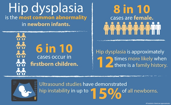 Hip Dysplasia Hip Dysplasia