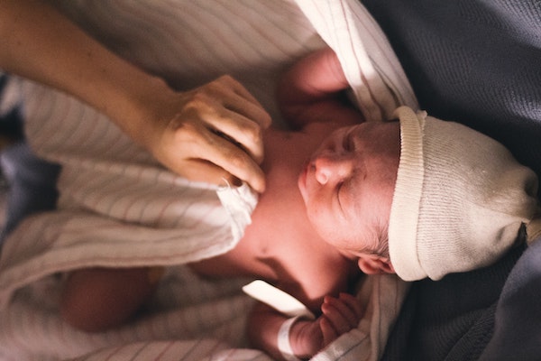 Swaddling & Hip Dysplasia Improper swaddling may put baby at higher risk of hip dysplasia