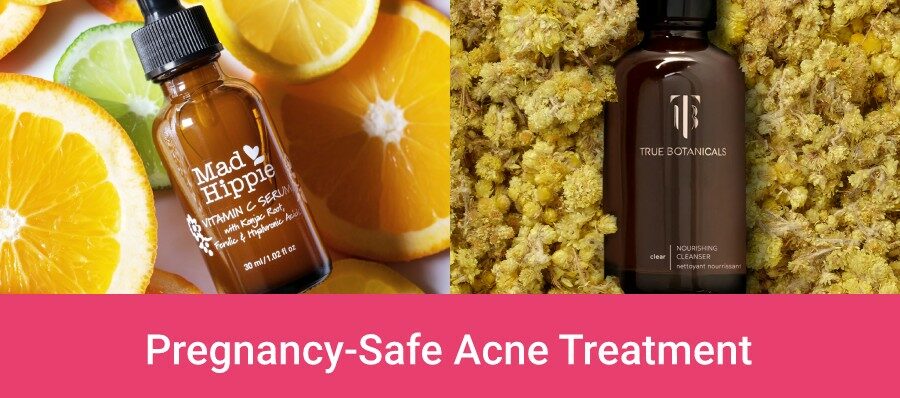 Best Pregnancy Safe Acne Treatments