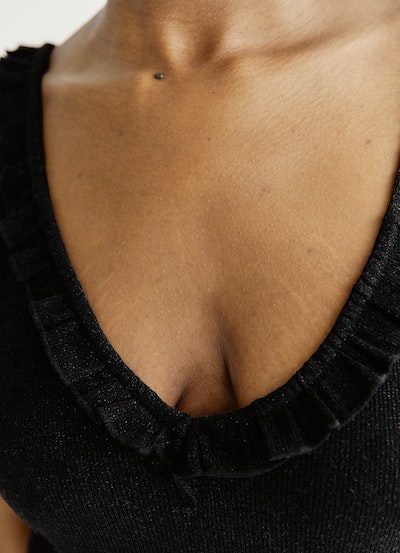 Pregnancy stretch marks on breasts