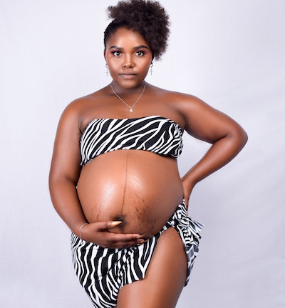 What pregnancy stretch marks look like