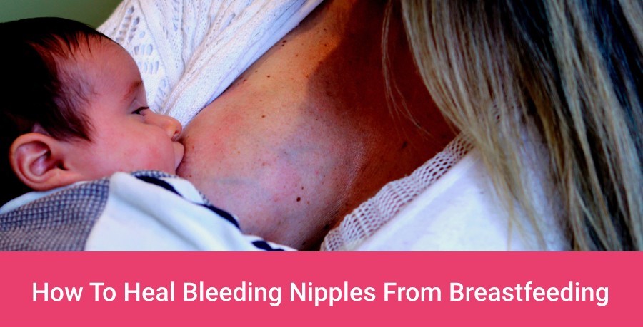 How To Heal Bleeding Nipples From Breastfeeding