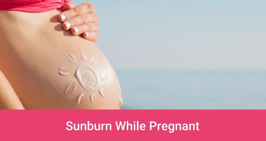 Sunburn while pregnant