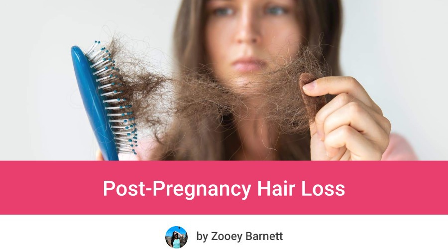 Post Pregnancy Hair Loss - How long does it last and can you prevent postpartum hair loss?