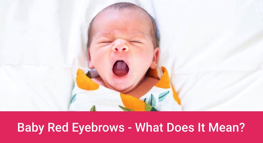 Baby Red Eyebrows What Does It Mean Should You Be Worried About Red Eyebrows In Babies